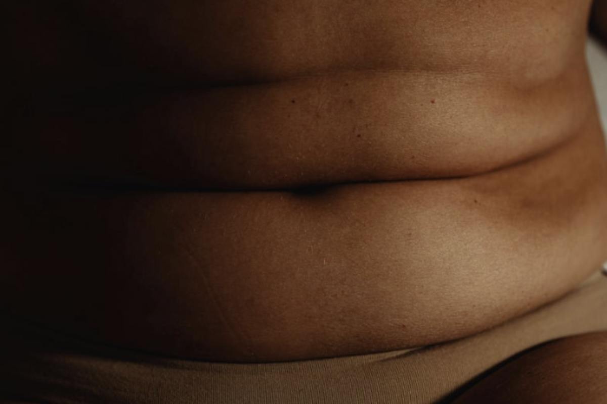 La cosiddetta lanugine ombelicale non nasce nel nostro corpo, ma arriva dall’esterno. È composta principalmente da fibre dei vestiti